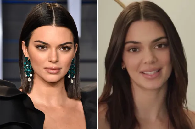 Cover Image for SMELLS FISHY Kendall Jenner’s critics are convinced she got a secret nose job after spotting ‘clear sign’ in new video